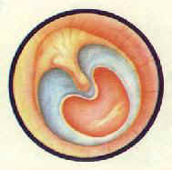 慢性化脓性中耳炎中央性大穿孔中耳粘膜充血