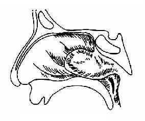 鼻咽血管纤维<a href=