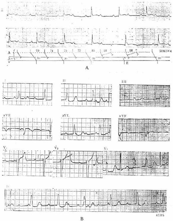 ��ȼ���ȷ��Ҵ������͵��ĵ�ͼ