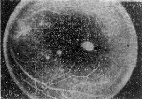 ����������Ĥ����Ĥ����