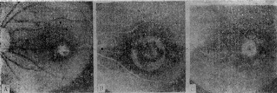 Rieger����������Ĥ��