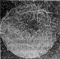 ����������Ĥ����