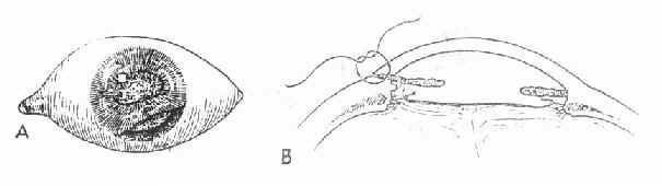 �����Ժ�Ĥ������Ϸ�Ϸ���