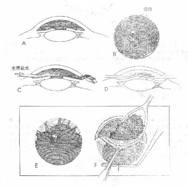 ǰ����Ѫ��������������