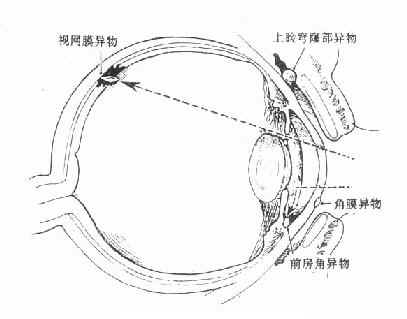 ����������λ��