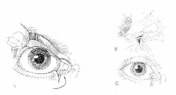 ��С���Ǻ���